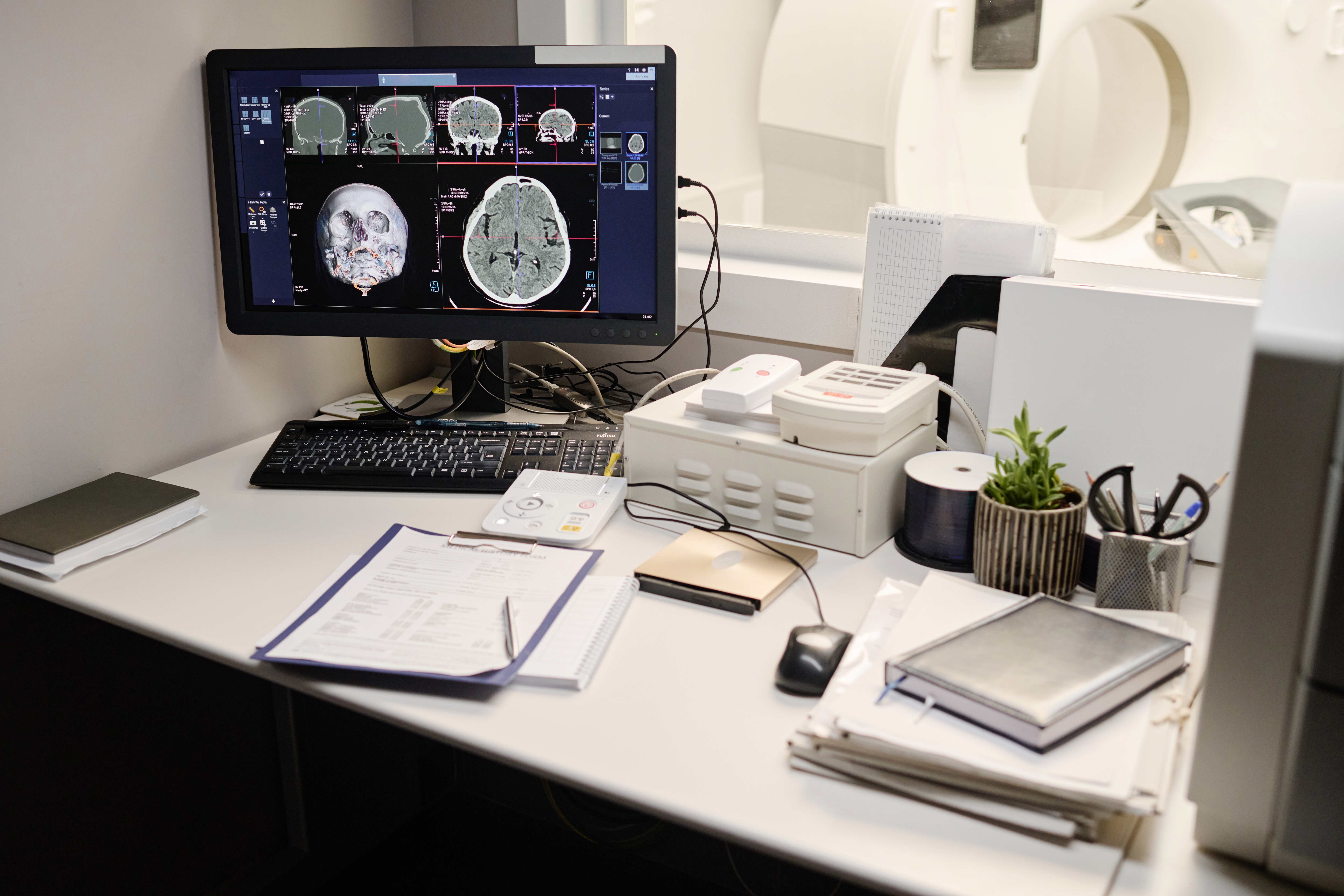 星状神経節ブロック